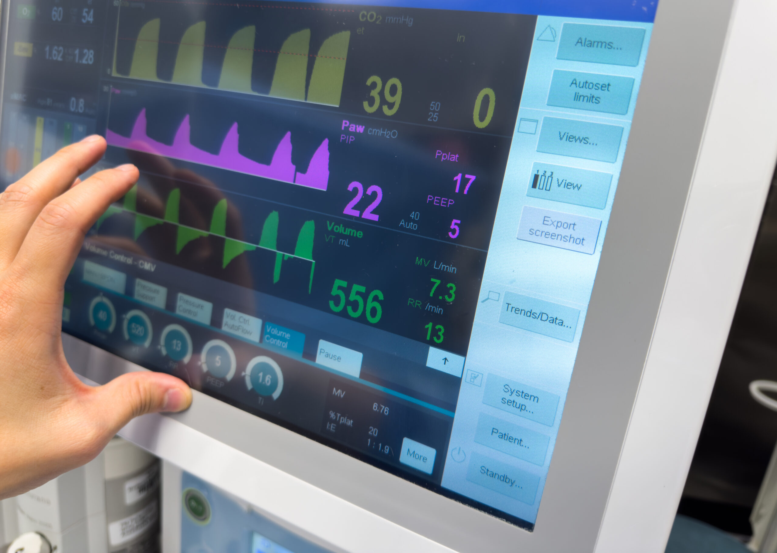 Hospital Monitor medical equipment displaying vital signs like heart rate, blood pressure, and oxygen levels on a hospital monitor, emphasizing health monitoring